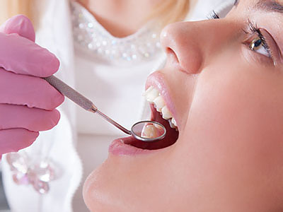 Georgetown Family Dental | Extractions, Juvederm reg and Dental Fillings